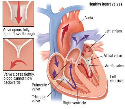 Heart Valve repair cost in India