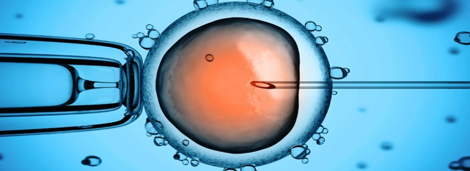 Cytoplasmic Sperm Injection