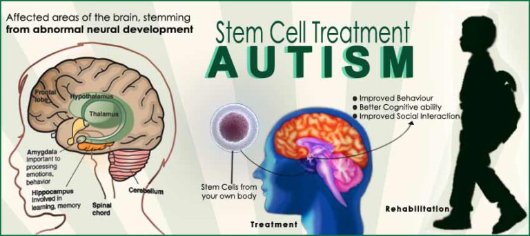 Autism Stem Cell Therapy in India