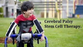 Cerebral Palsy Stem Cell Therapy in Turkey - Find Cost and Reviews ...