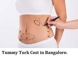 What is Tummy Tuck Surgery Cost