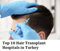 Top 10 Hair Transplant Hospitals in Turkey - Find Best Surgeon, Cost and  Reviews. - Expert Chikitsa