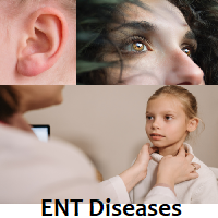 ENT Diseases